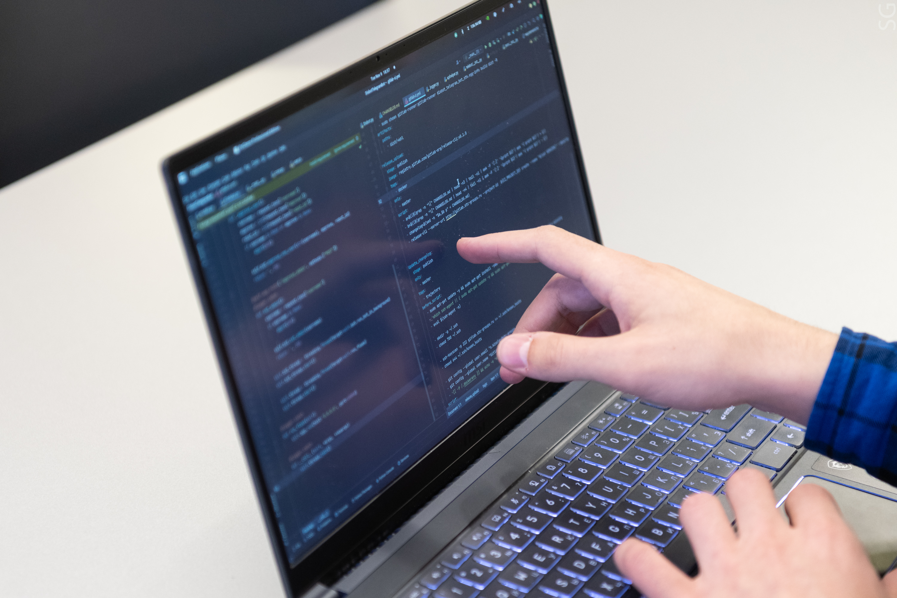 Қарт әйелдердің клиторы мен анусы